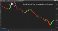 NinjaTrader Epic Uturn Settings 10